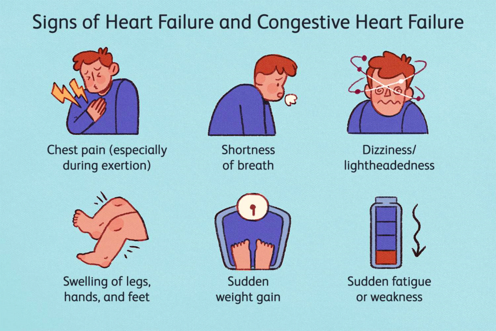 Congestive Heart Failure: