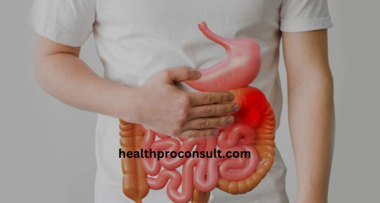 What Are the Symptoms of Colorectal Cancer?​